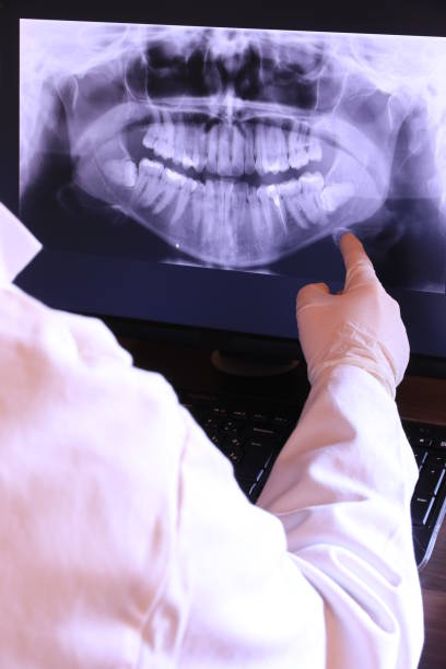 Best Emergency Tooth Extraction in Bowdon, GA