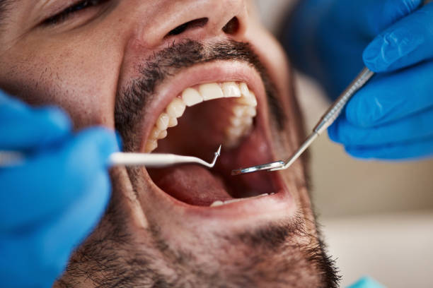 Best Pediatric Emergency Dentist in Bowdon, GA