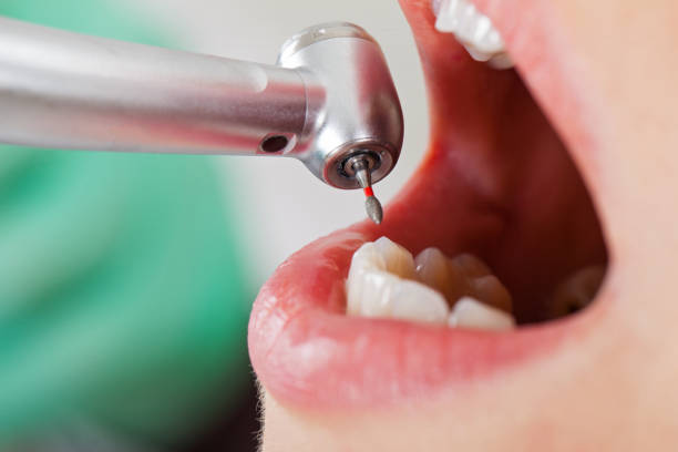 Best Emergency Dental Care for Trauma or Injury in Bowdon, GA